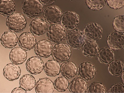 ecoli1